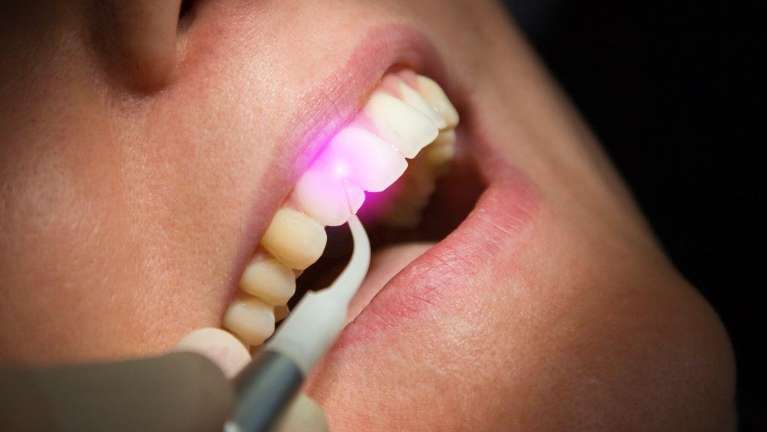 patient getting laser dental treatments in south charlotte
