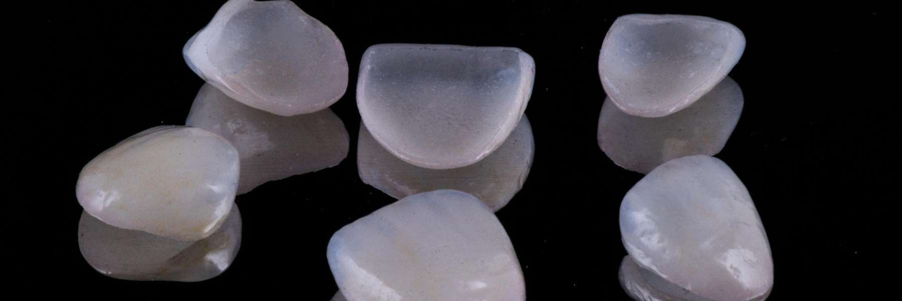 porcelain dental veneers