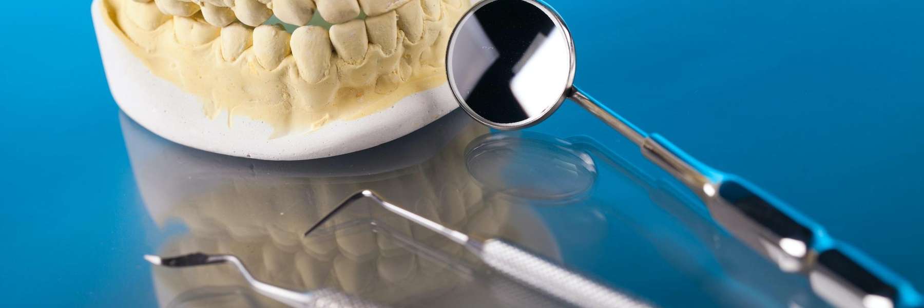 dental cleanings south charlotte