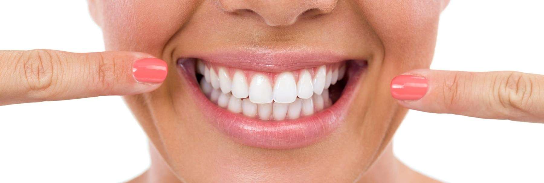 charlotte woman pointing to her teeth after invisalign treatment