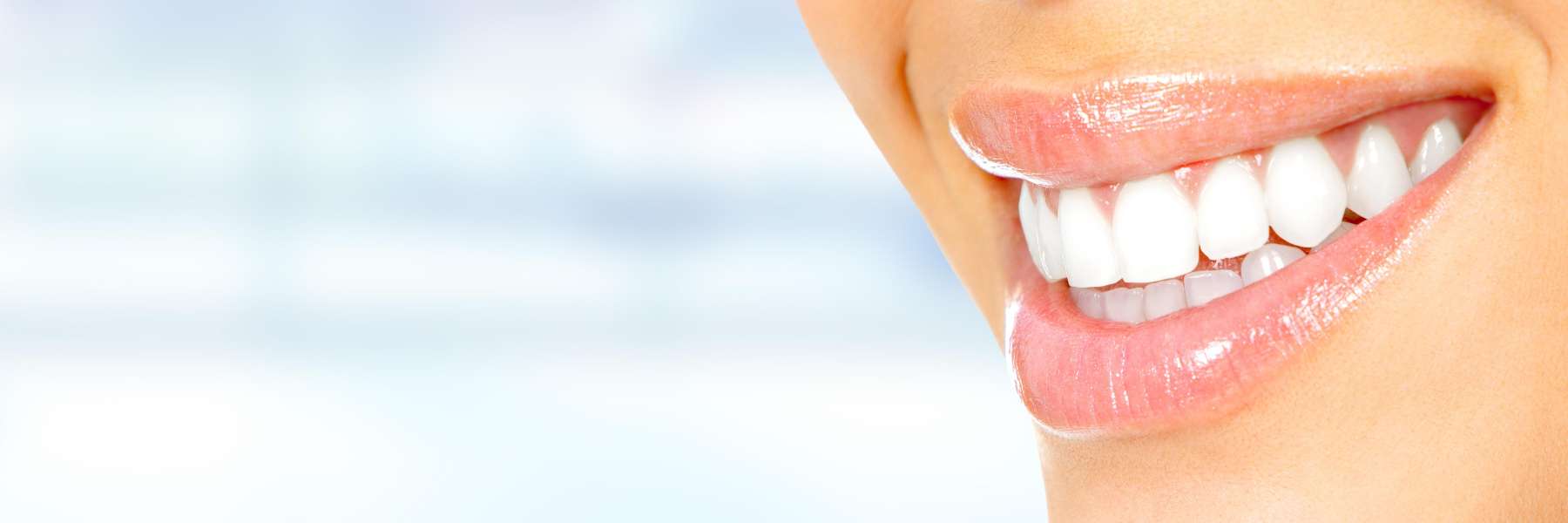 A charlotte woman's lips with white teeth 