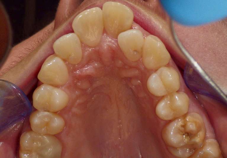 before extensive multi-disciplinary treatment plan
