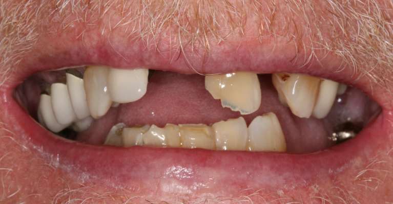 cosmetic dentistry case in charlotte- before