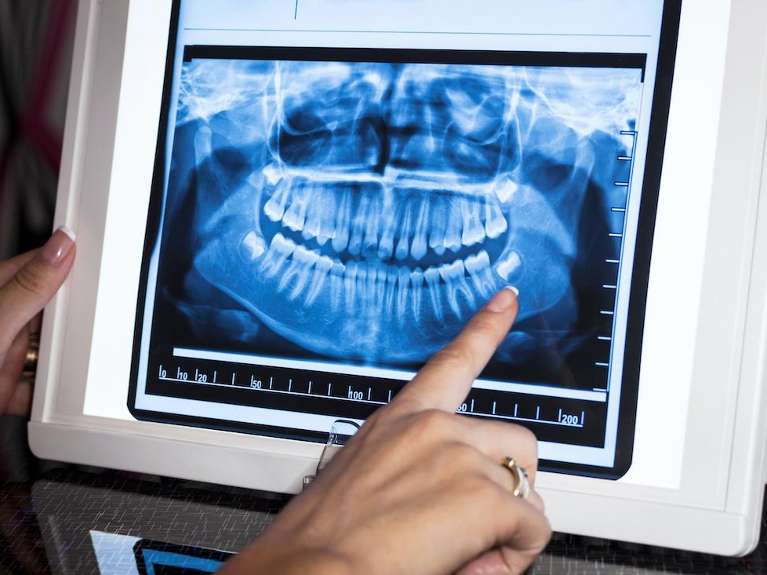 Digital X-Rays
