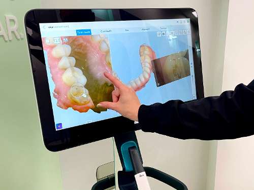 iTero Scanner at our south Charlotte dental office